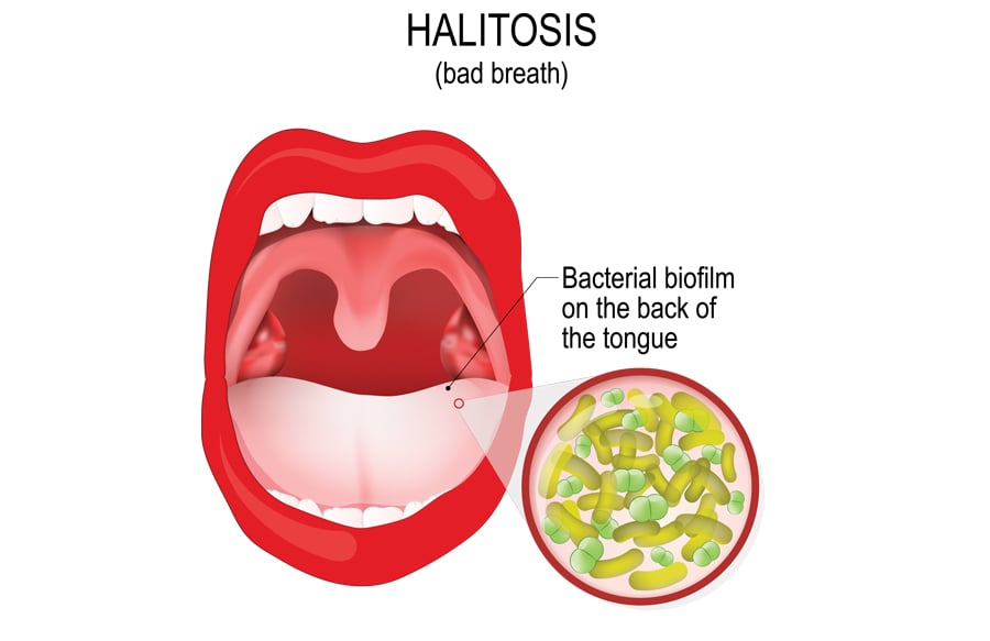 What is Biofilm—and Why it Matters to Your Swimming Pool or Hot Tub